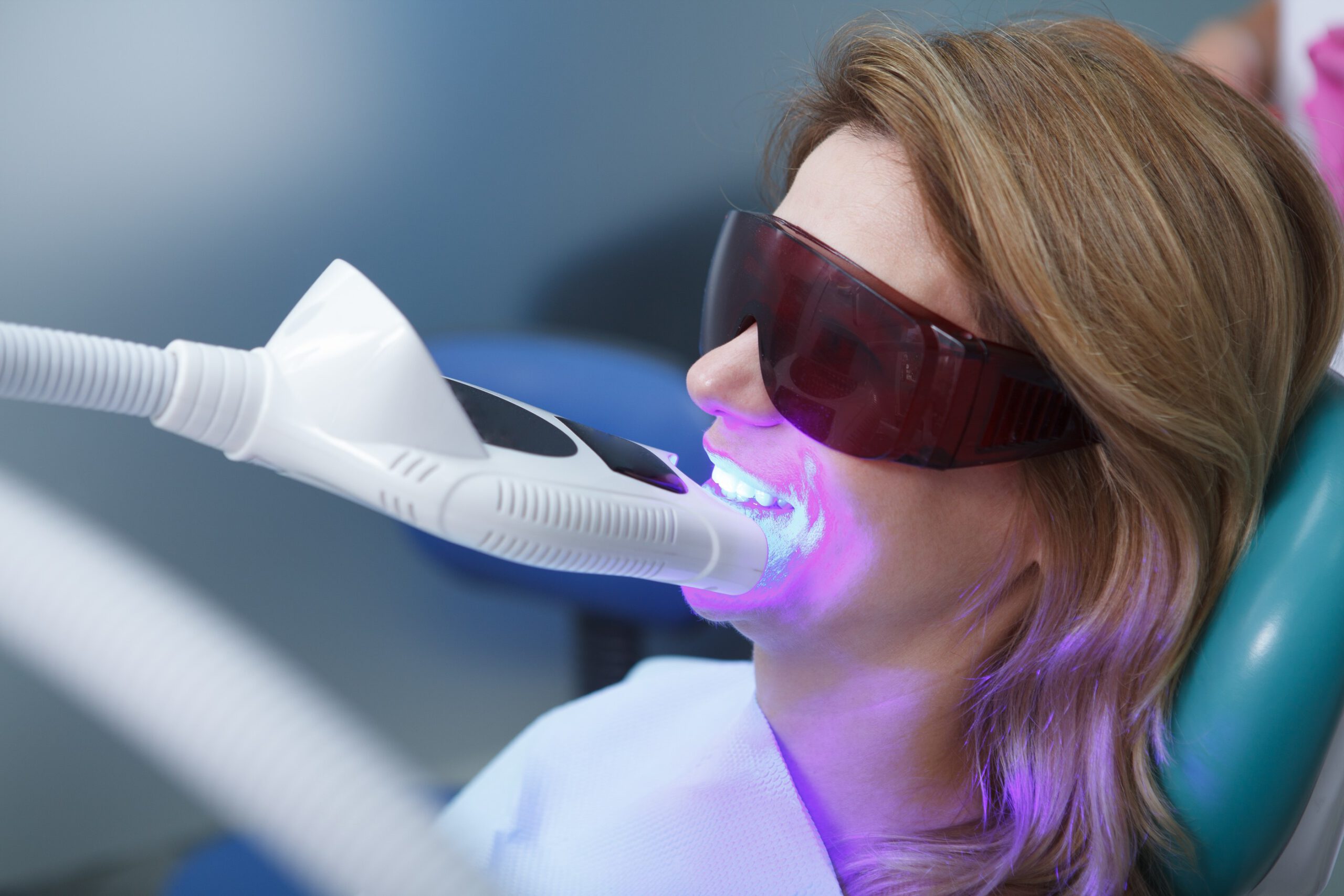 Imagen de Como se hace un blanqueamiento dental