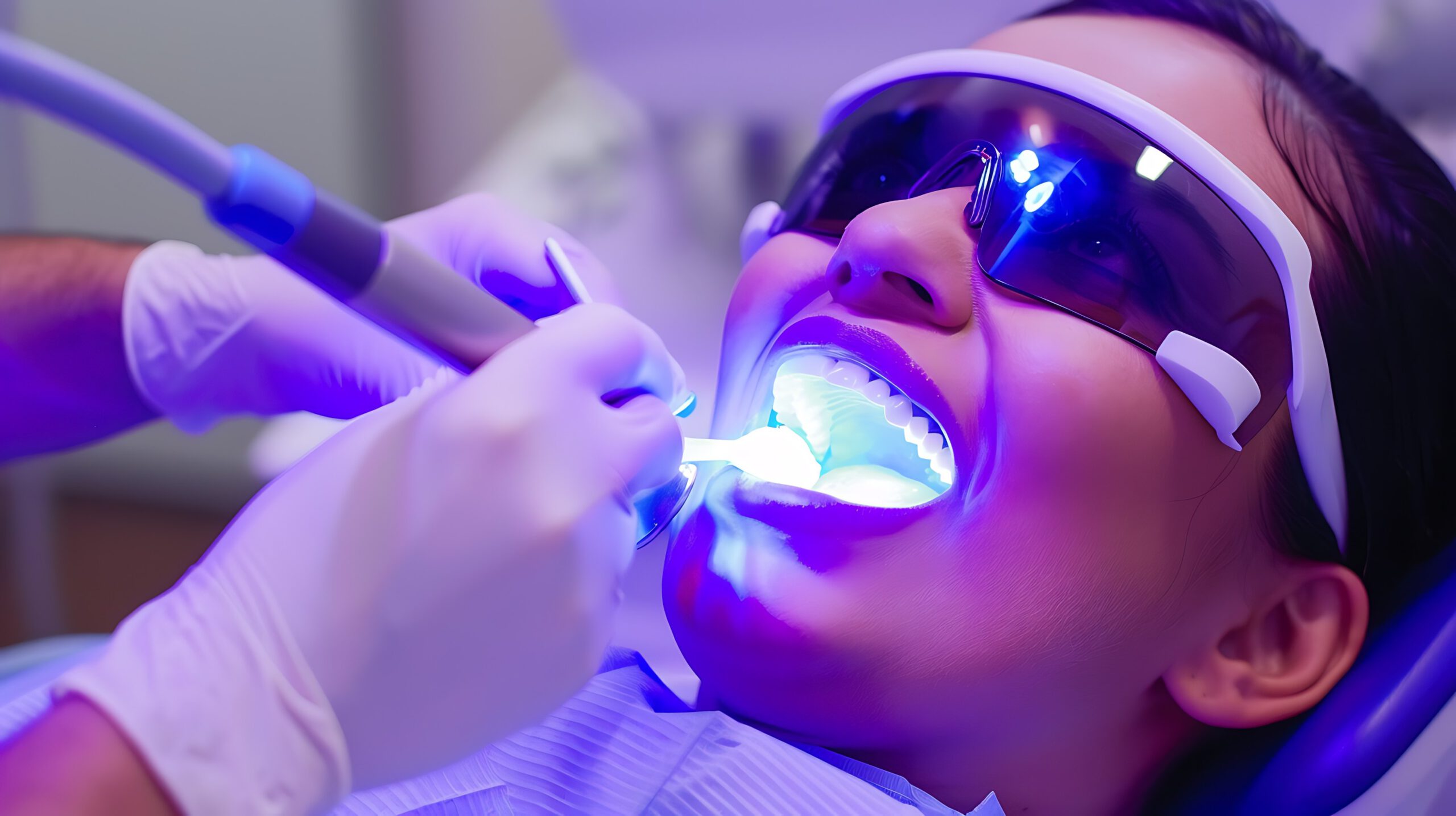 Imagen de Duracion blanqueamiento dental